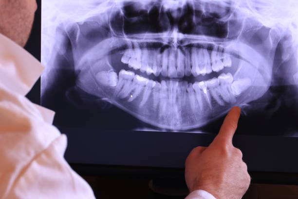 Best After-Hours Dental Trauma Care in Princeton Meadows, NJ